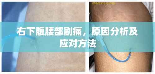 右下腹腰部剧痛,原因分析及应对方法