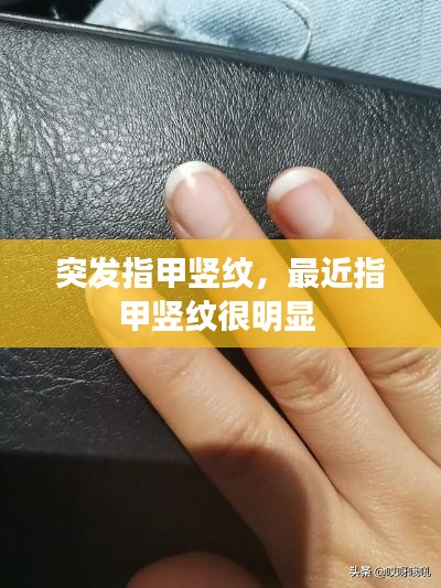 突发指甲竖纹，最近指甲竖纹很明显 