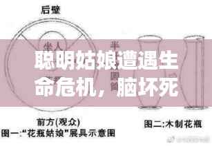 聪明姑娘遭遇生命危机，脑坏死谜团待解